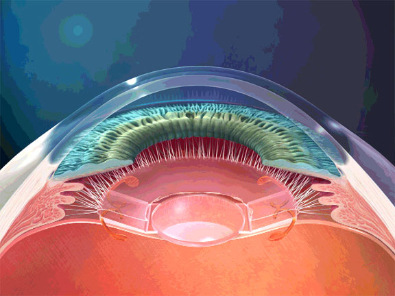 Best eye Hospital in Nala road | Best retina doctor in patna| Best eye Hospital in patna| eye Hospital in patna| Best phaco specialist in patna| Best eye clinic In patna| Best eye clinic In bihar